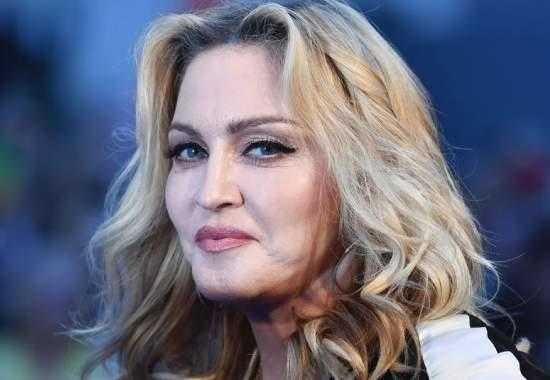 Madonna Madonna-Health-Update What-happened-to-Madonna